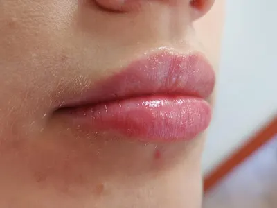 Stomatologia i Medycyna Estetyczna Jolanta Blicharska